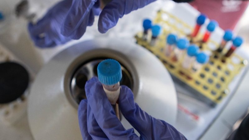 Se agiliza la carga de actas de toma de muestras para diagnósticos de sanidad animal